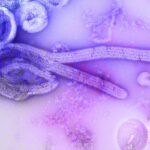 2026 Ebola Outbreak: What You Need To Know